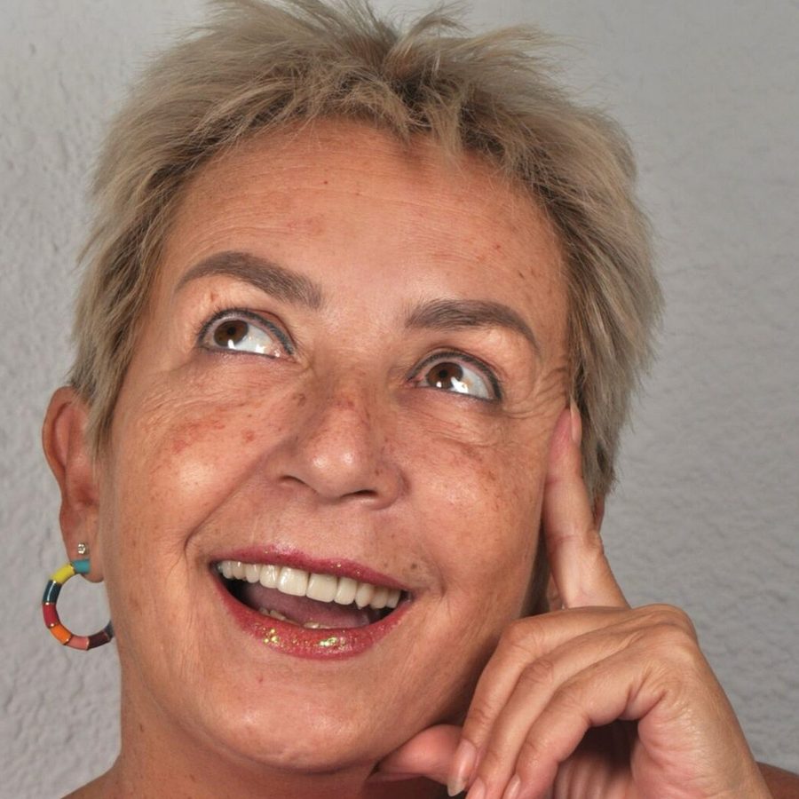 Carillas de porcelana en Málaga, transformación completa de la sonrisa (caso 3)