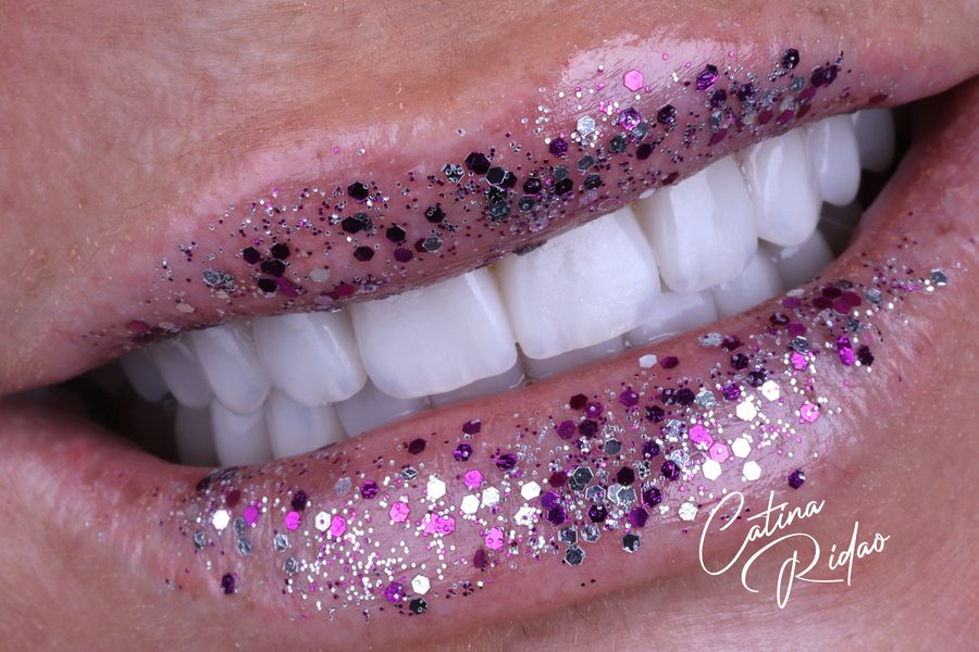 Macro de labios y dientes con purpurina, fotografía dental artística en Málaga