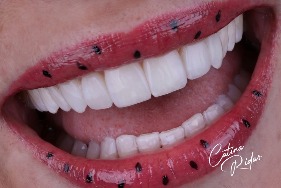 Sonrisa con labios rojos y detalle de los incisivos