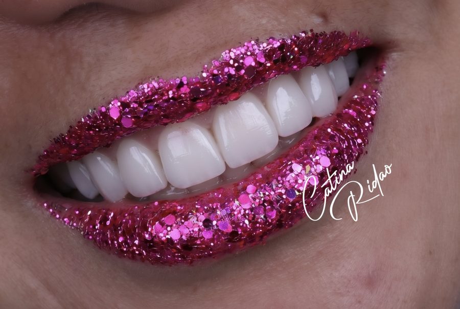 Macro de labios con purpurina fucsia y dientes blancos