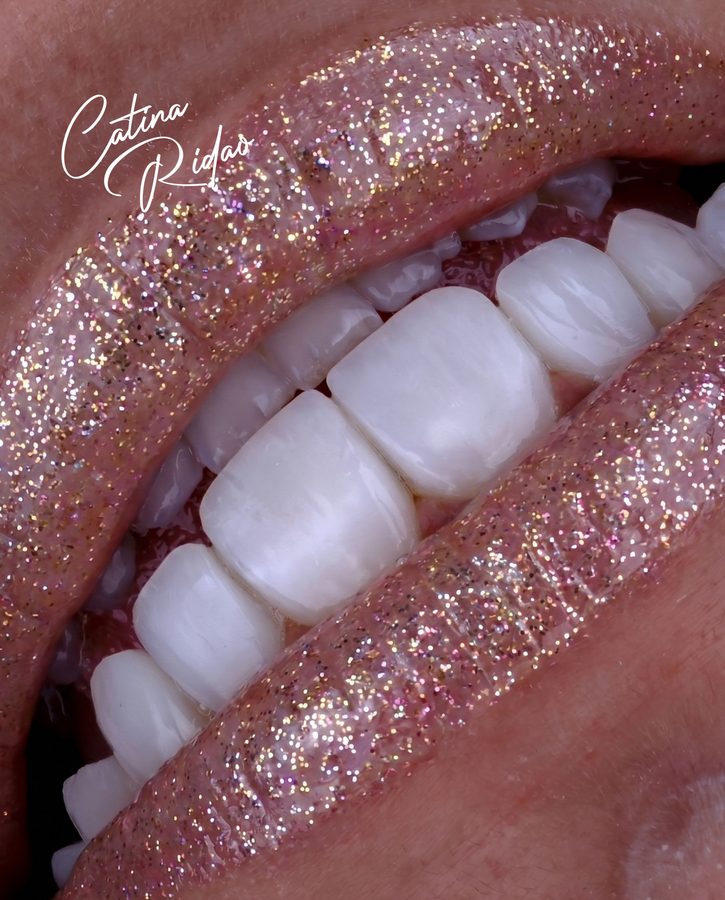 Detalle de una sonrisa con labios brillantes, macro dental