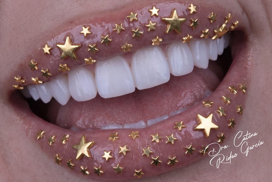 Labios con purpurina dorada y estrellas sobre los dientes
