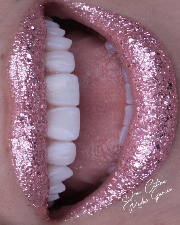 Macro frontal de labios y dientes con brillos