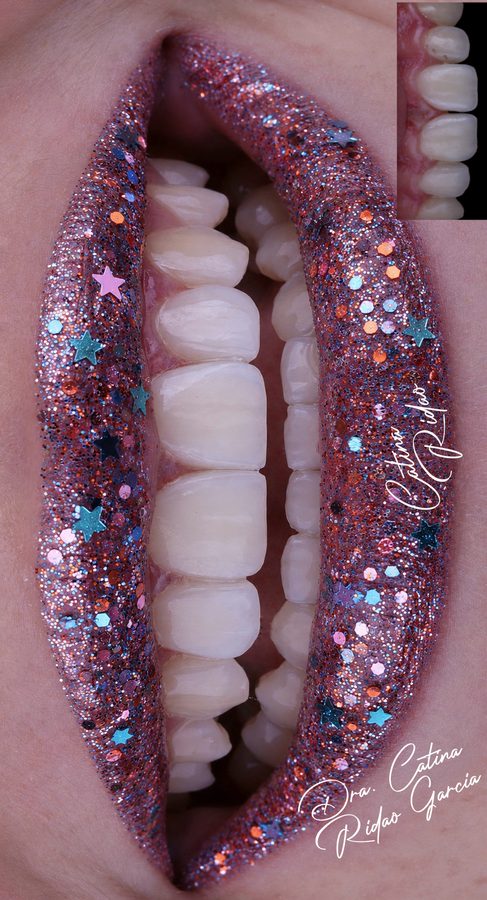 Detalle de labios con purpurina y estrellas de colores