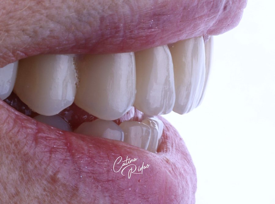 Perfil de la sonrisa sobre fondo claro, fotografía dental