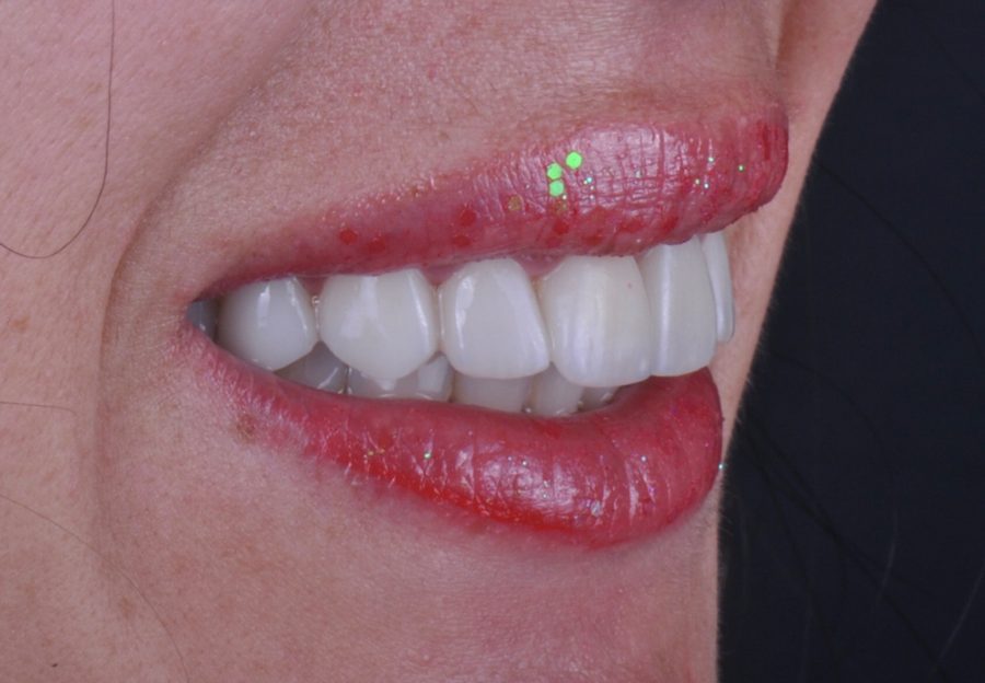 Sonrisa lateral con labios brillantes, macro dental