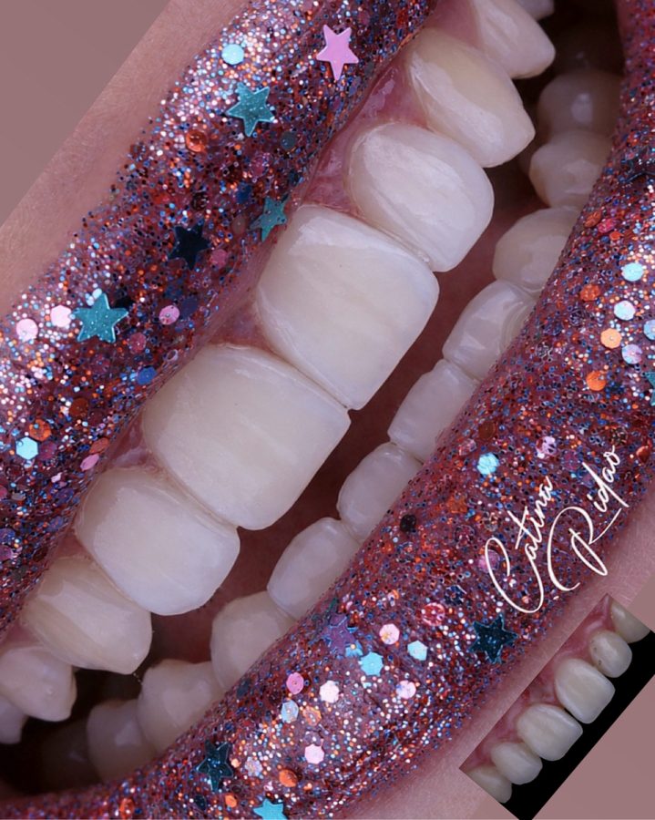 Sonrisa con purpurina y estrellas, fotografía dental creativa