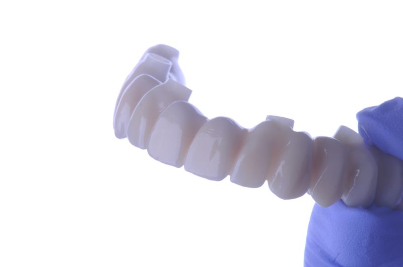 Carillas cerámica implantes Málaga rehabilitación oral completa