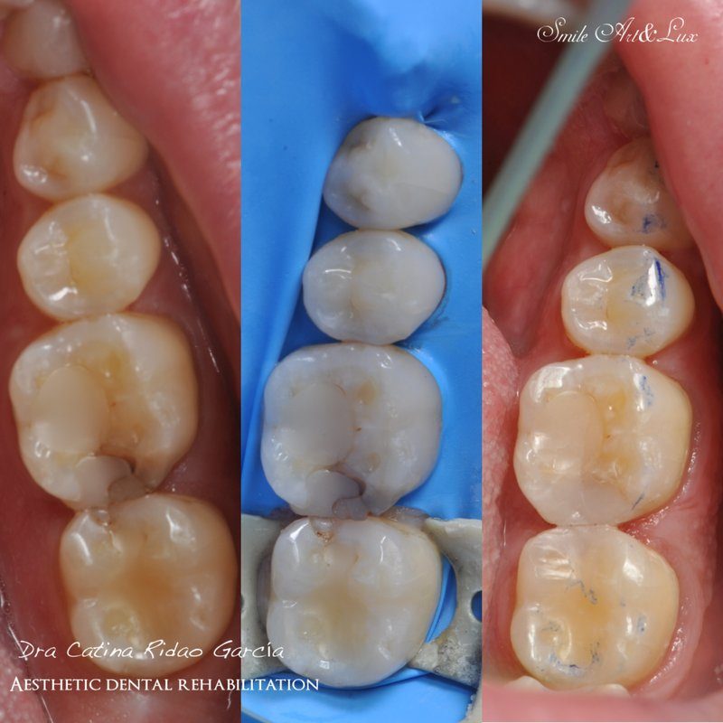 Odontología general Málaga